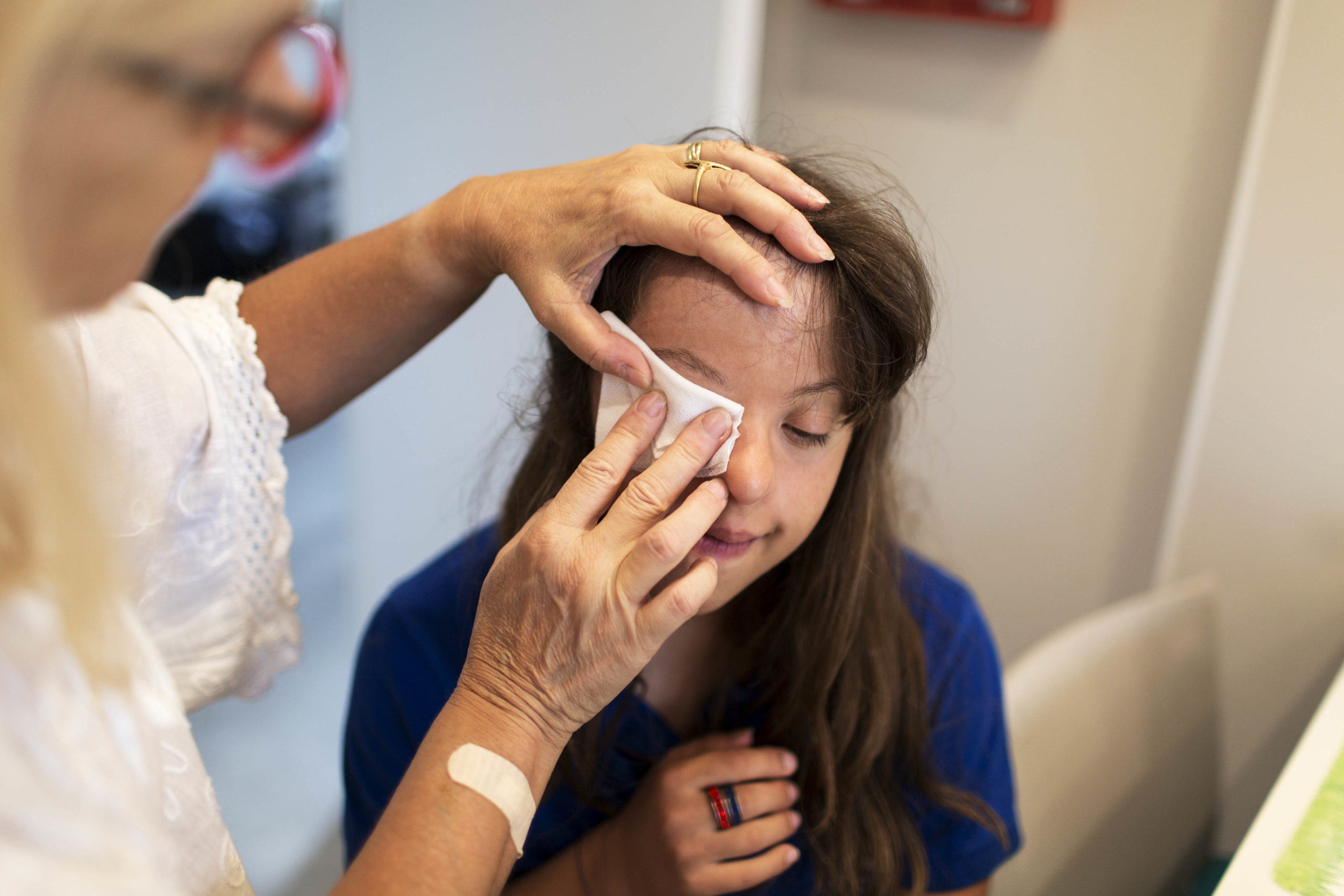 Nadine applique un traitement sur l’oeil de Carla, l’oeil est gonflé. Carla est sujette à de nombreuses infections.